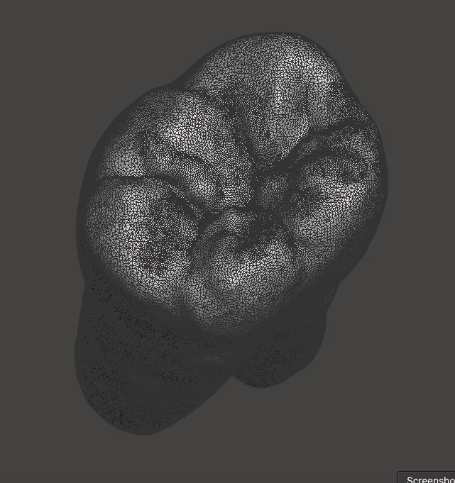 Left side Mandibular first molar Free 3D print model_3
