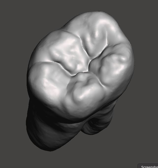 Left side Mandibular first molar Free 3D print model_1