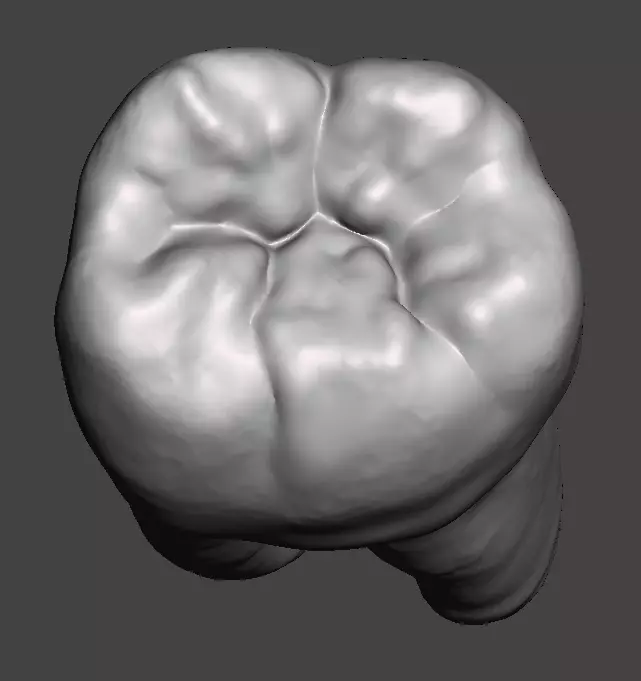 Left side Mandibular first molar Free 3D print model_0