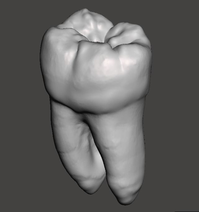 Left side Mandibular first molar Free 3D print model_2