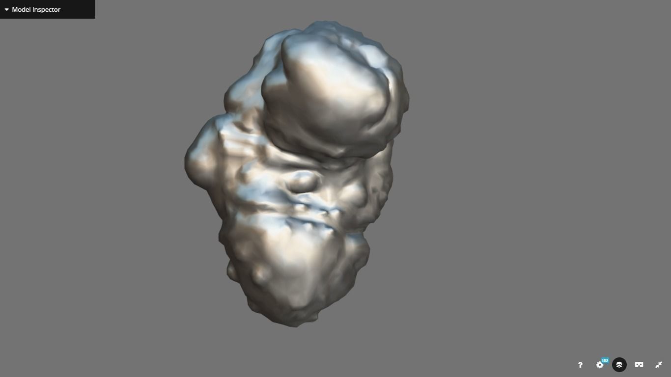Polycistic Kidney Low-poly 3D model_14
