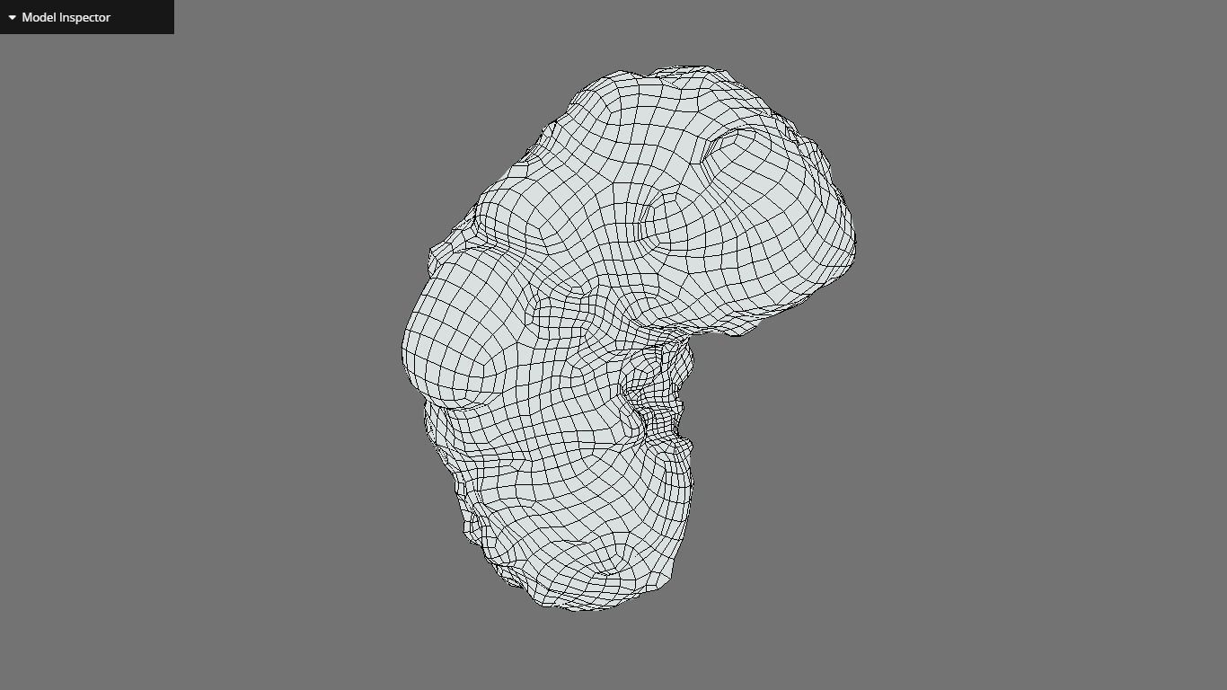 Polycistic Kidney Low-poly 3D model_23