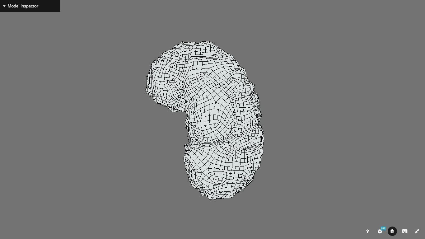 Polycistic Kidney Low-poly 3D model_20