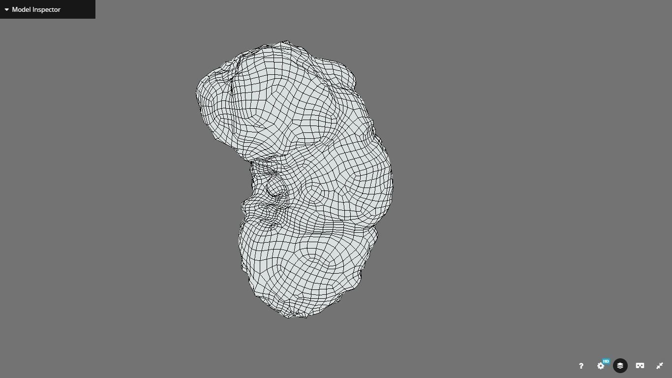Polycistic Kidney Low-poly 3D model_19