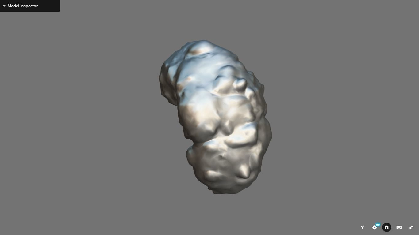 Polycistic Kidney Low-poly 3D model_16