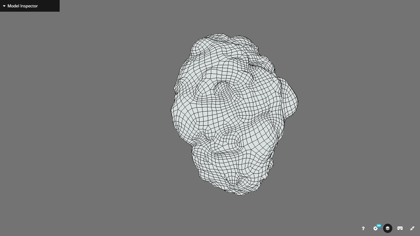 Polycistic Kidney Low-poly 3D model_21