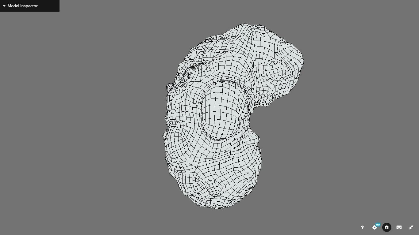 Polycistic Kidney Low-poly 3D model_17