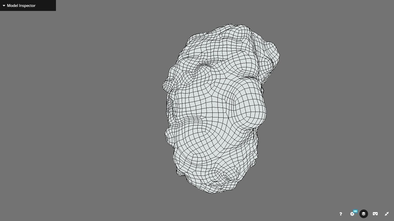 Polycistic Kidney Low-poly 3D model_22