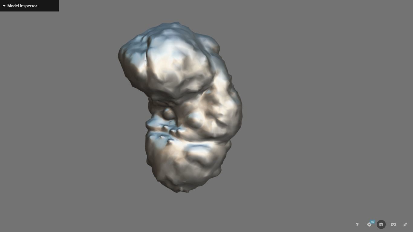 Polycistic Kidney Low-poly 3D model_15