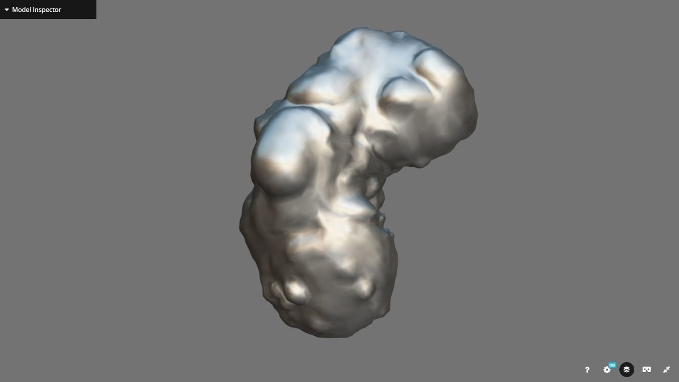 Polycistic Kidney Low-poly 3D model_13
