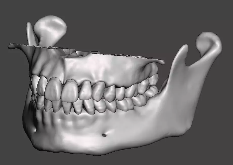 D012 Maxillary and Mandibular dental models anatomical teeth 3D print model_0