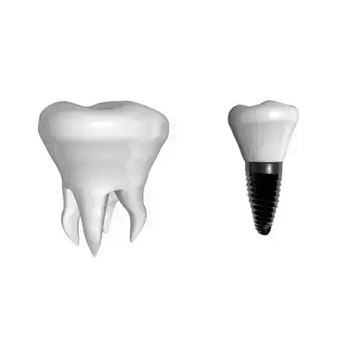 Tooth white implant dentistry prosthetics Free 3D model
