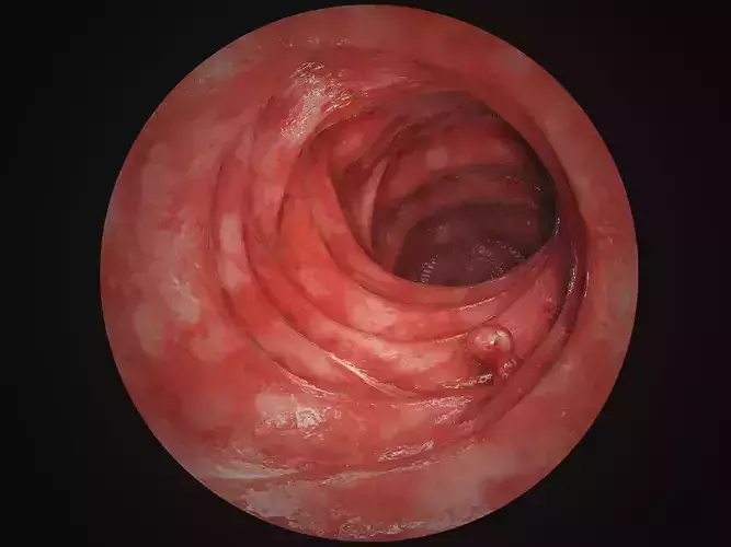 Intestine tract 3D model