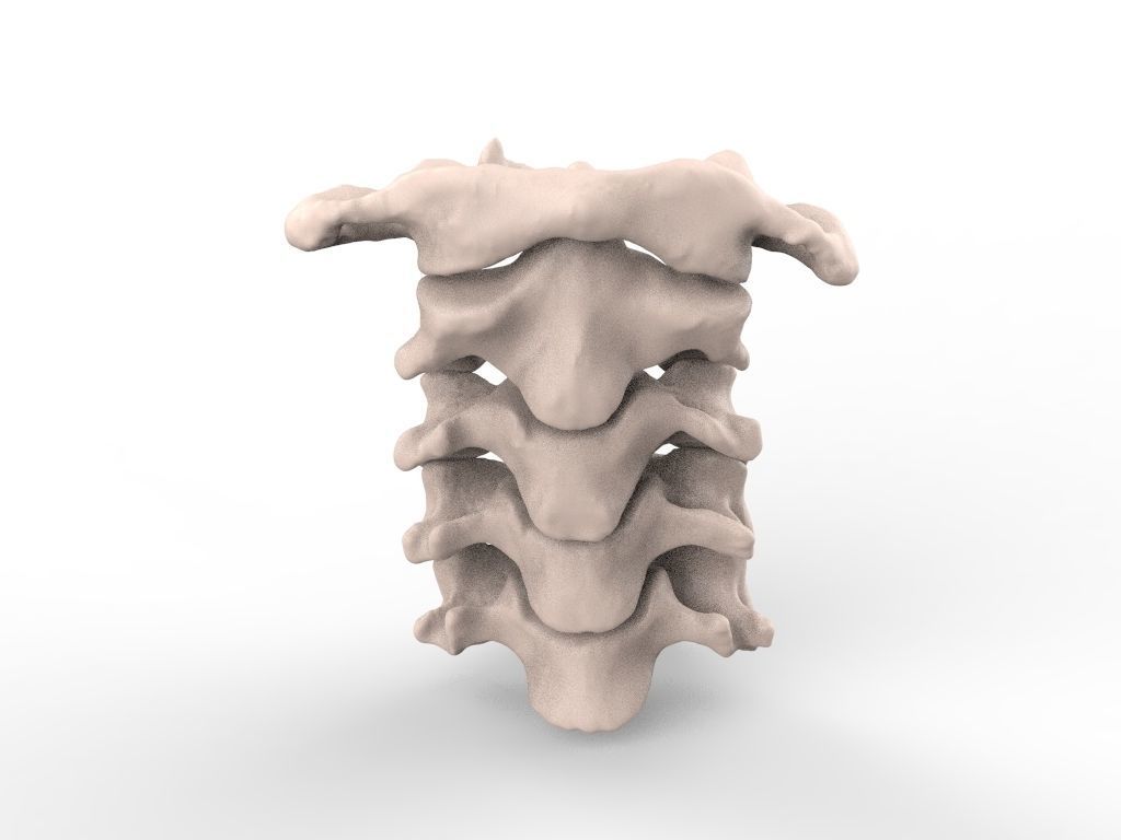 Cervical Spine C1-C5  3D print model_4