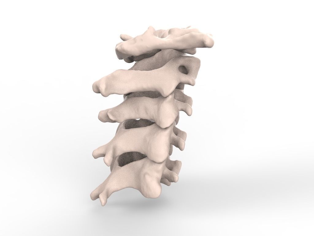 Cervical Spine C1-C5  3D print model_6