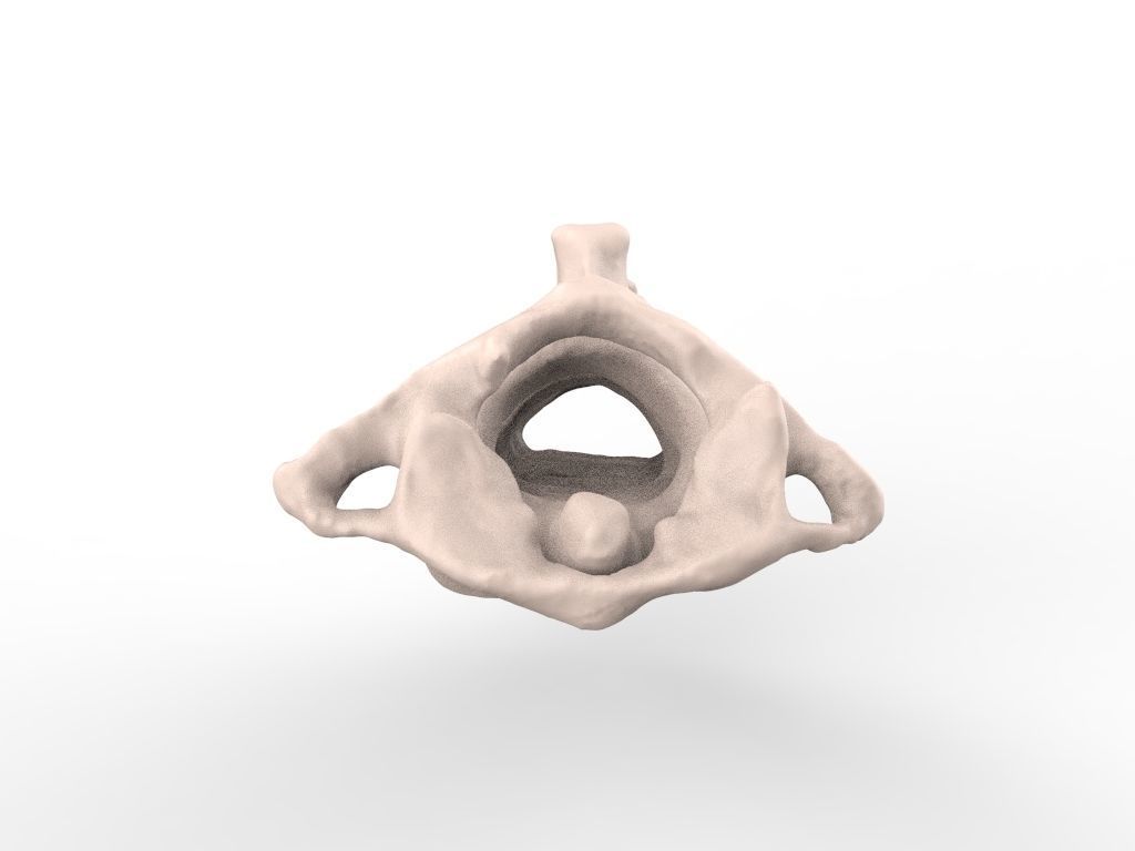 Cervical Spine C1-C5  3D print model_7