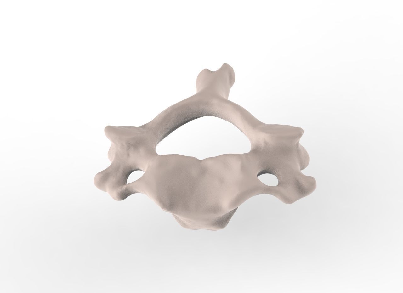 Cervical Spine C1-C5  3D print model_10
