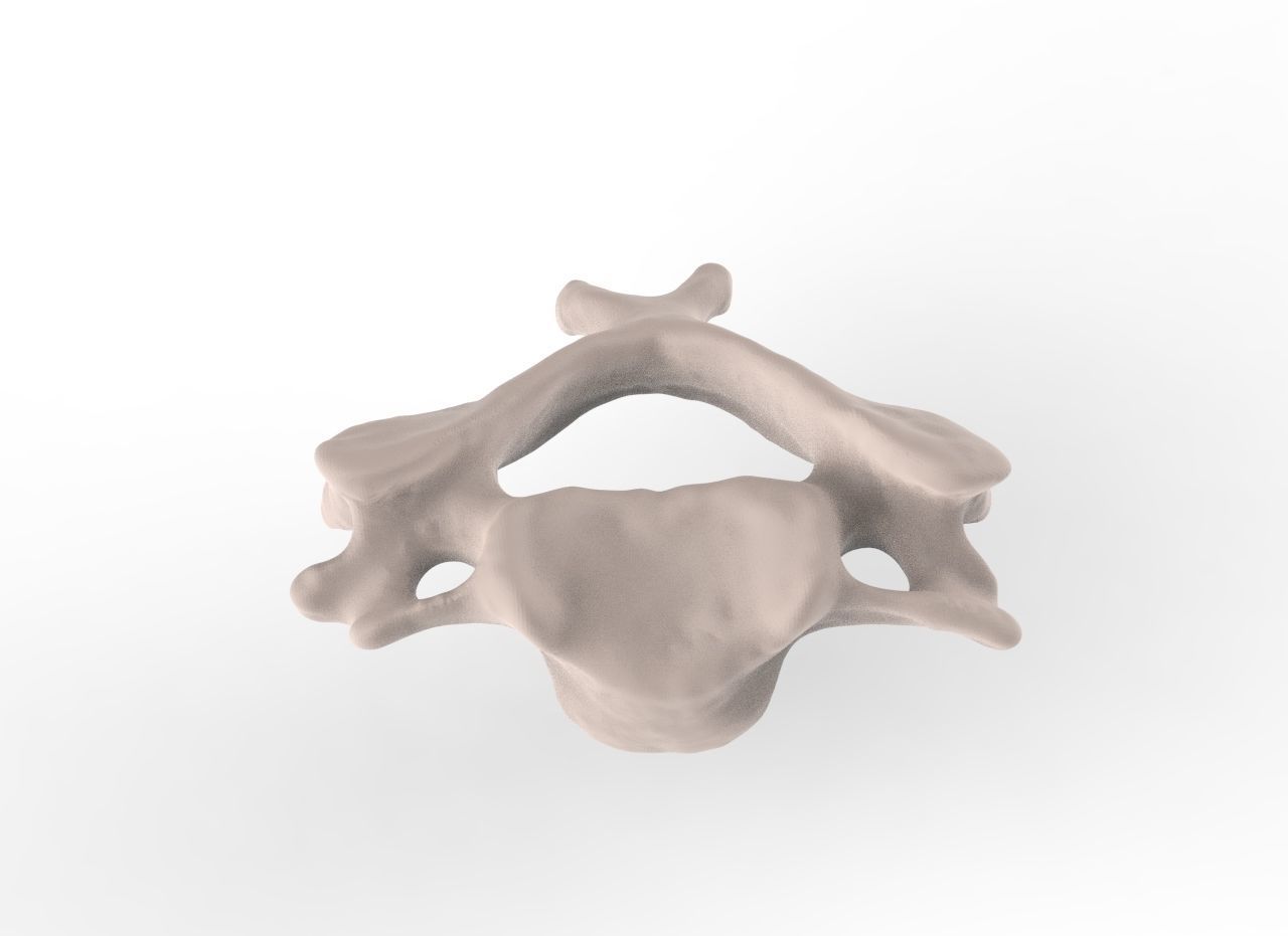 Cervical Spine C1-C5  3D print model_11