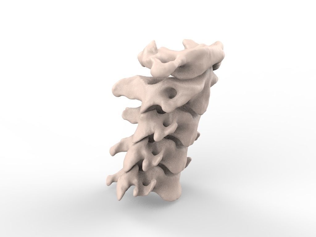 Cervical Spine C1-C5  3D print model_1