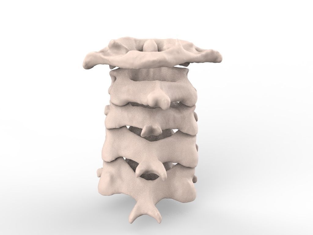 Cervical Spine C1-C5  3D print model_2