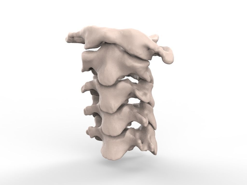 Cervical Spine C1-C5  3D print model_5