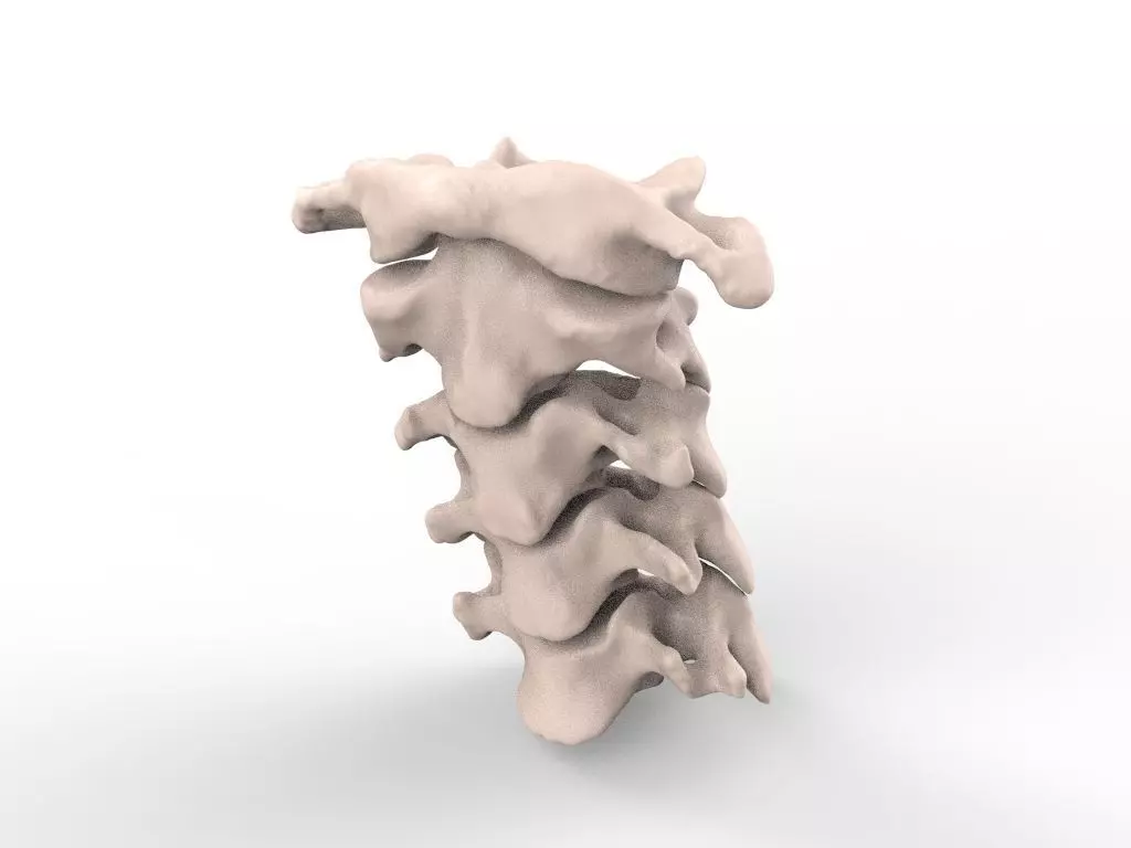 Cervical Spine C1-C5  3D print model_0