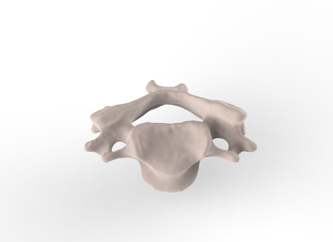 Cervical Spine C1-C5  3D print model_12