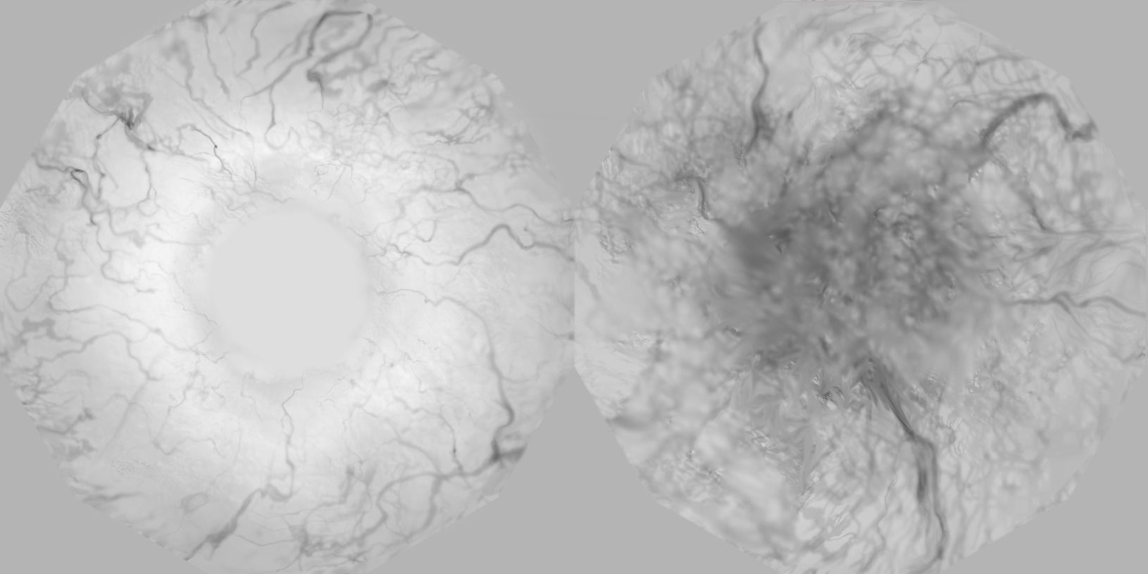 the eyes human eye Free 3D model_5