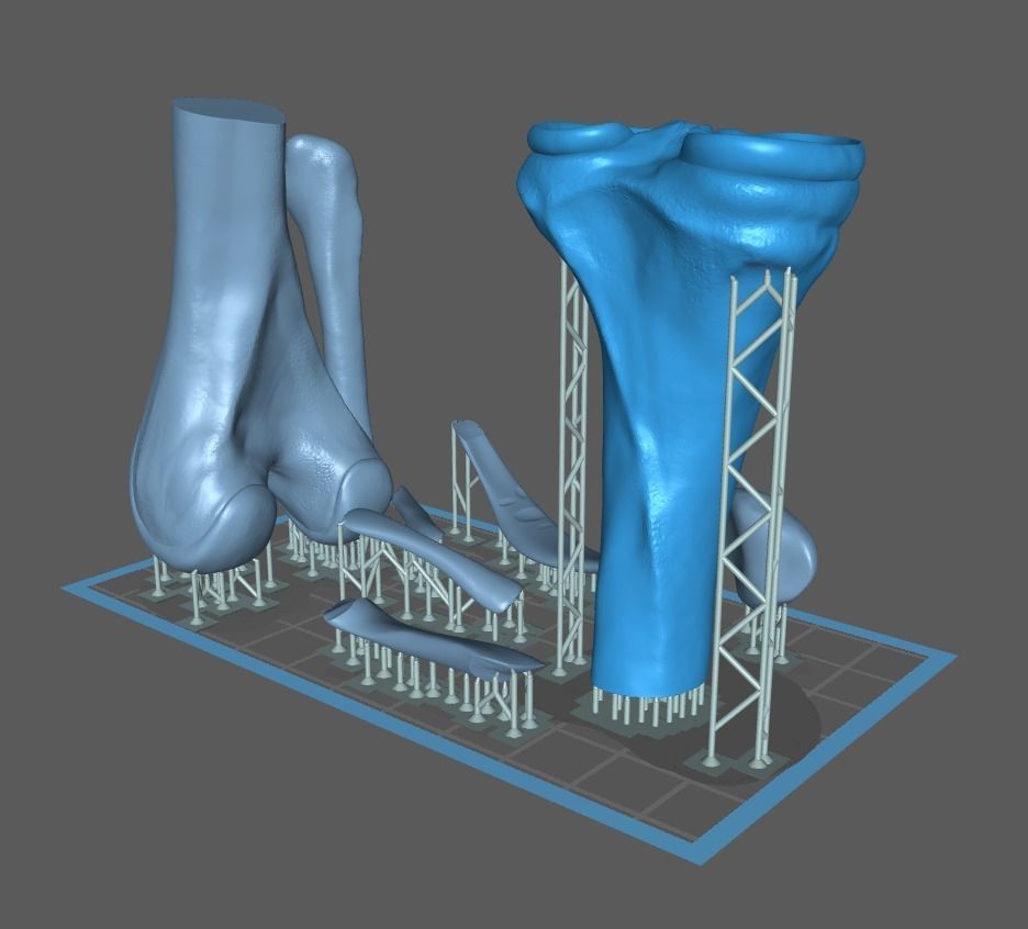 Knee ligaments model 3D print model_27