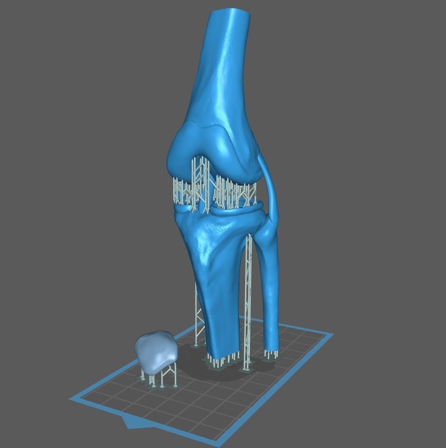 Knee ligaments model 3D print model_23
