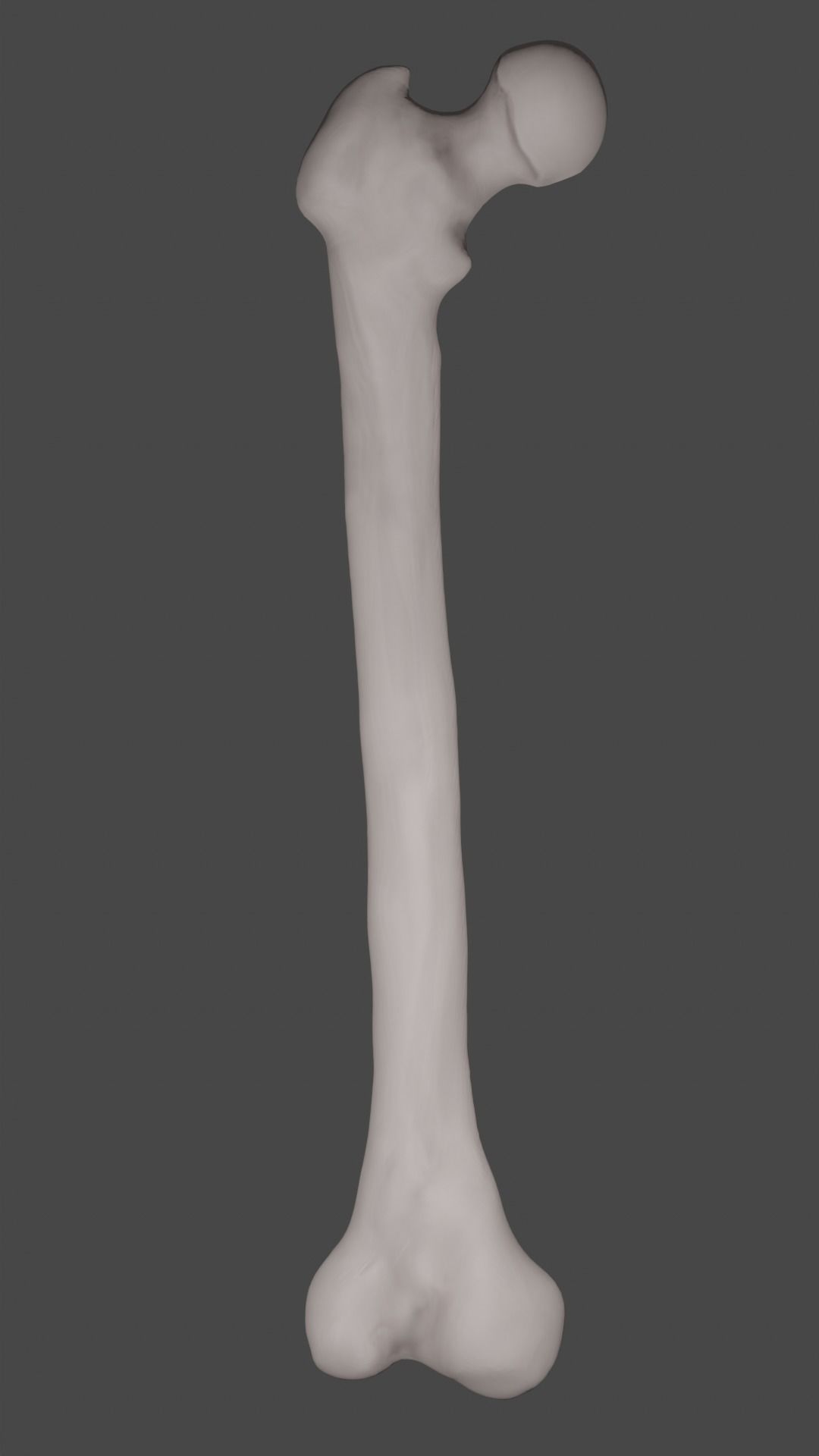 Femur bone closed and sliced 3D model_7