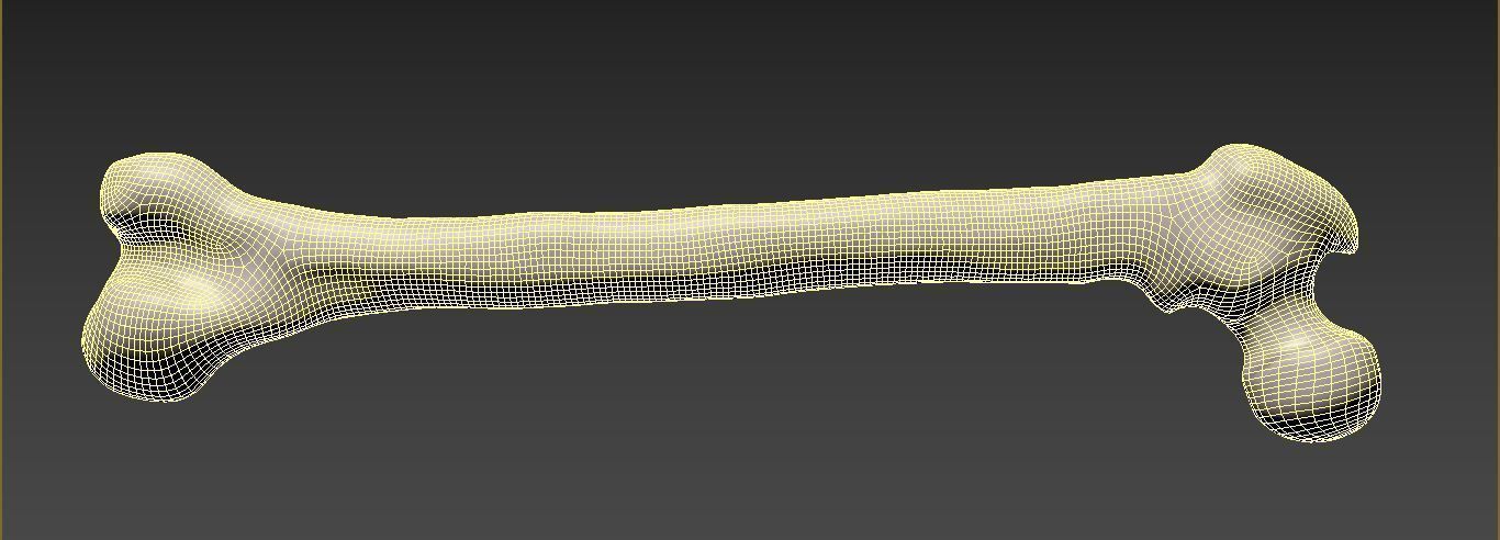 Femur bone closed and sliced 3D model_9