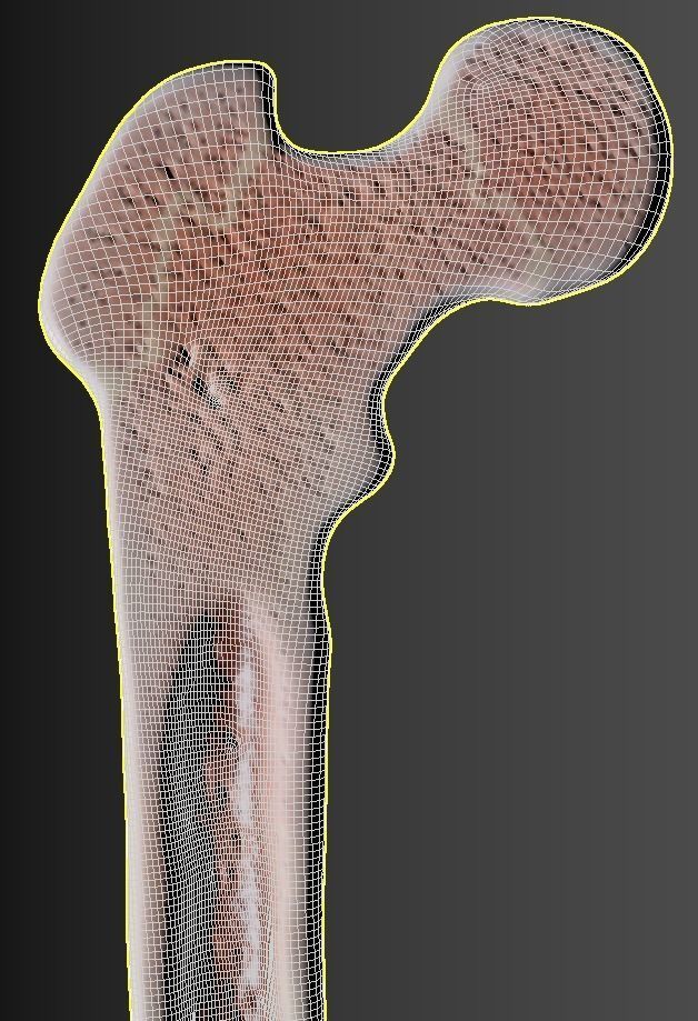 Femur bone closed and sliced 3D model_26