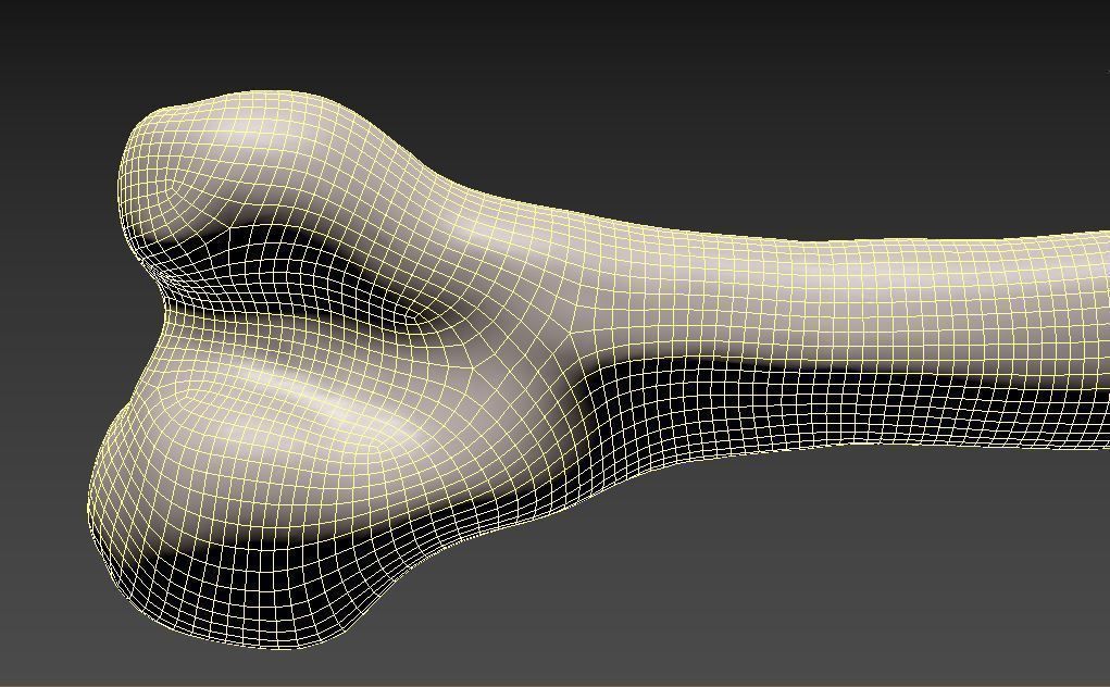Femur bone closed and sliced 3D model_12