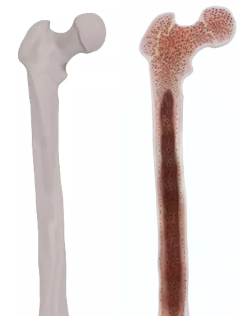 Femur bone closed and sliced 3D model_0