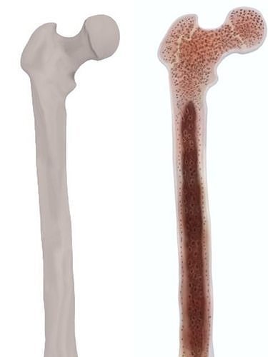 Femur bone closed and sliced 3D model
