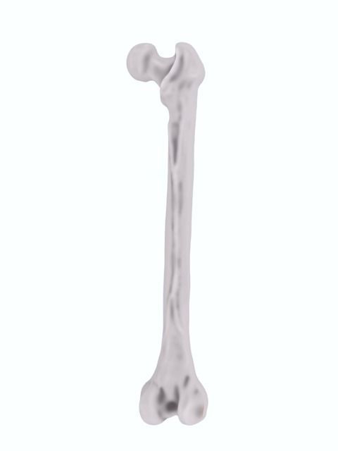 Femur bone closed and sliced 3D model_17