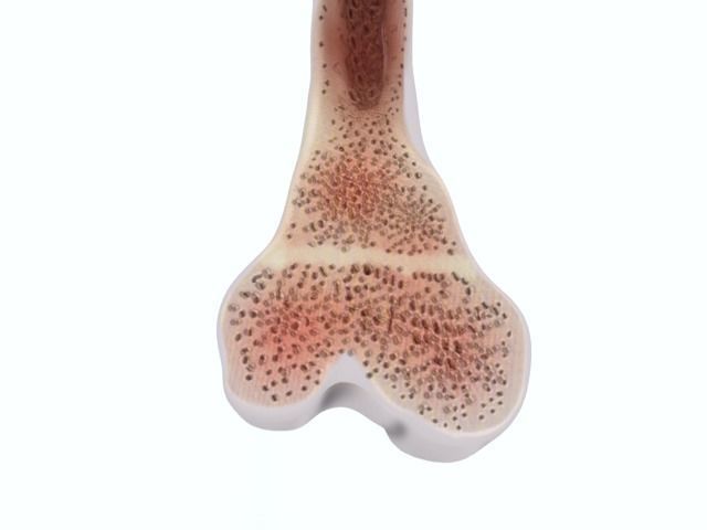 Femur bone closed and sliced 3D model_21