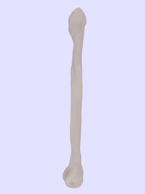 Femur bone closed and sliced 3D model_2