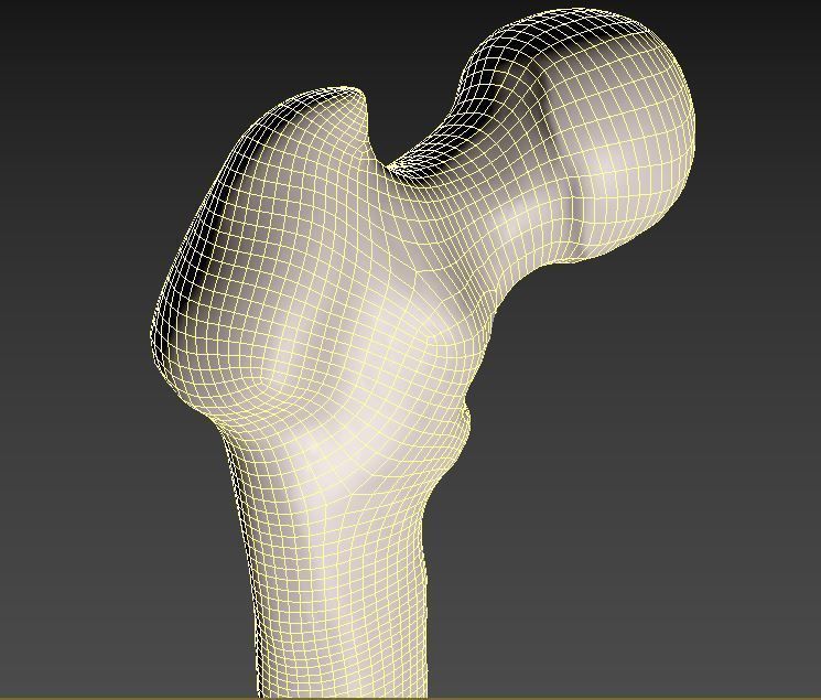Femur bone closed and sliced 3D model_14