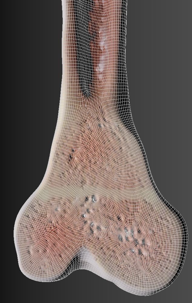 Femur bone closed and sliced 3D model_27