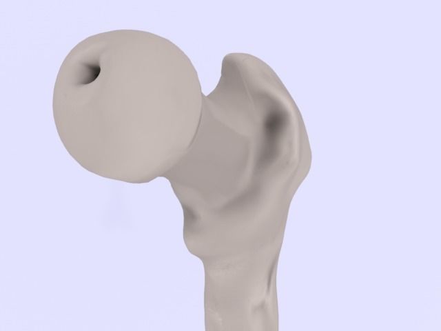 Femur bone closed and sliced 3D model_6