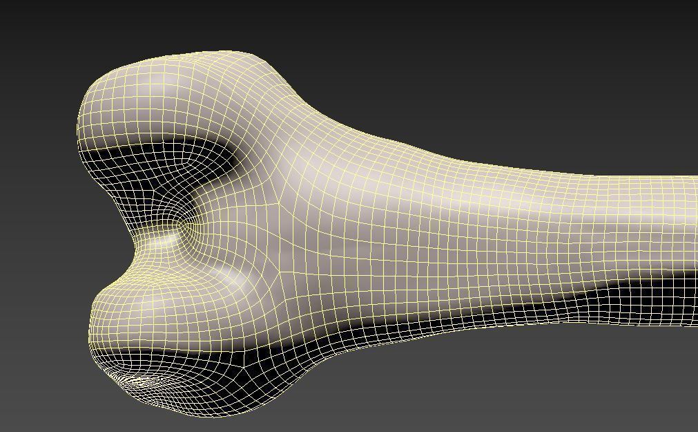 Femur bone closed and sliced 3D model_11