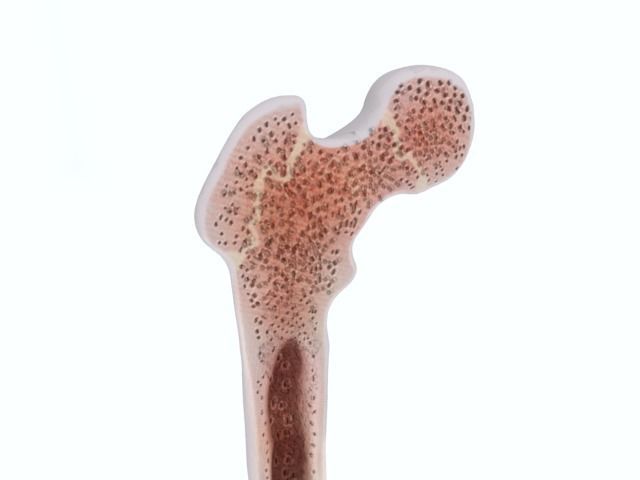 Femur bone closed and sliced 3D model_23