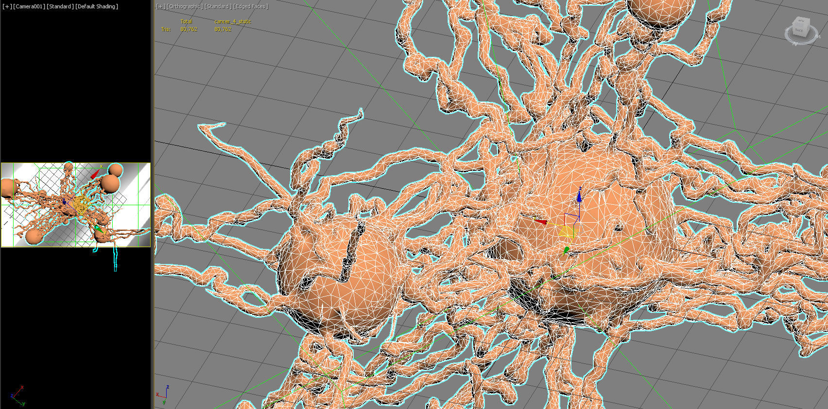 Cancer Growth 4 PBR Low-poly 3D model_15