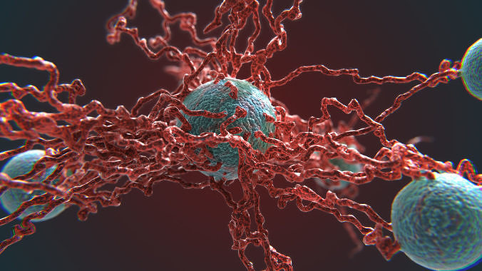 Cancer Growth 4 PBR Low-poly 3D model