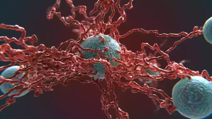 Cancer Growth 4 PBR Low-poly 3D model