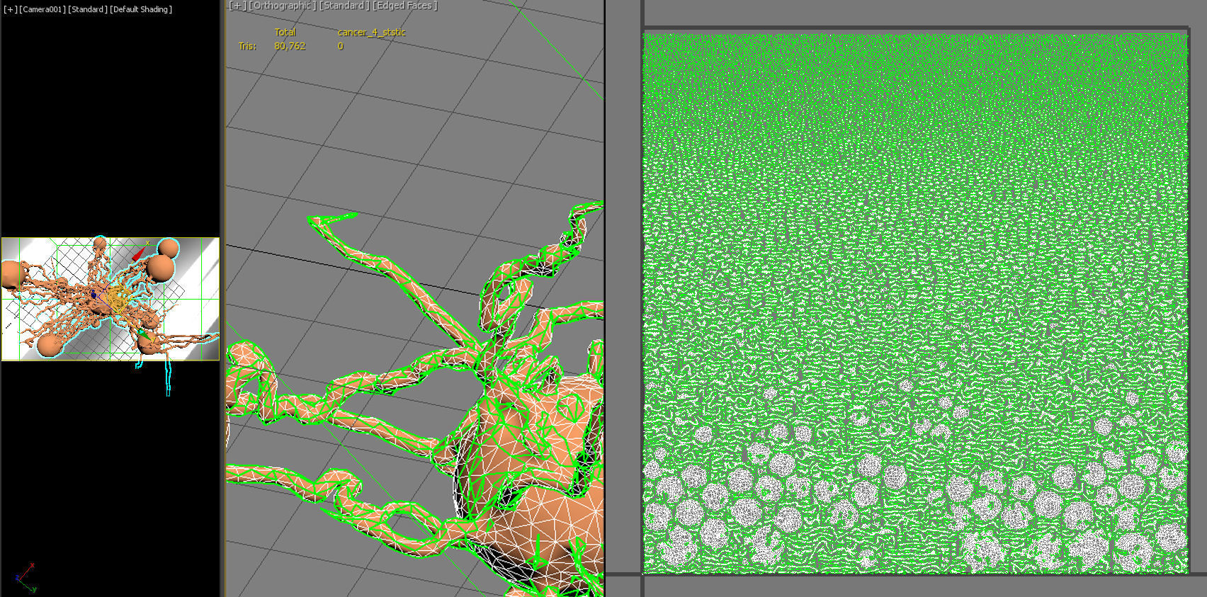 Cancer Growth 4 PBR Low-poly 3D model_16