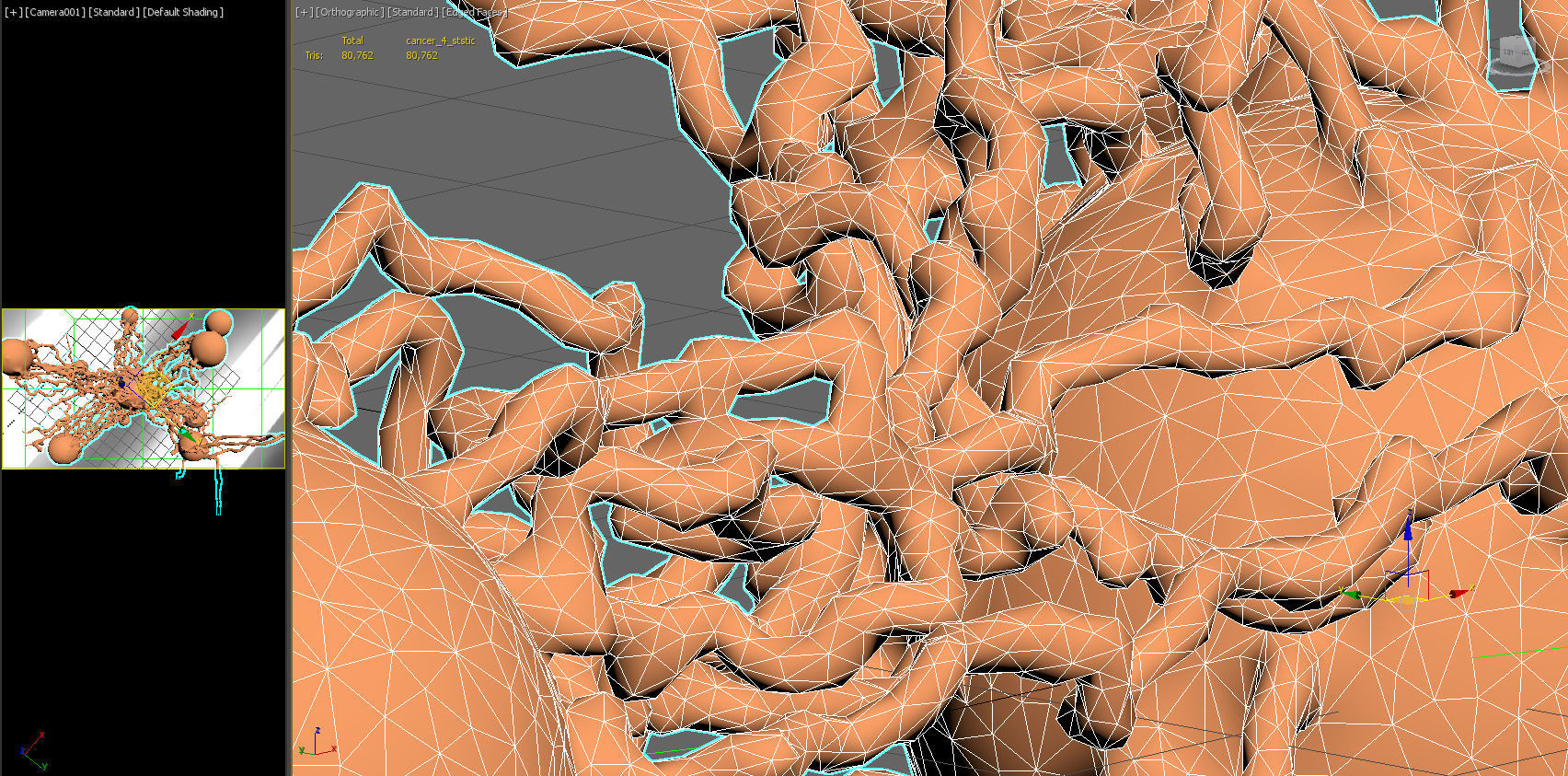 Cancer Growth 4 PBR Low-poly 3D model_14