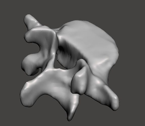 human vertebra L5 3D print model